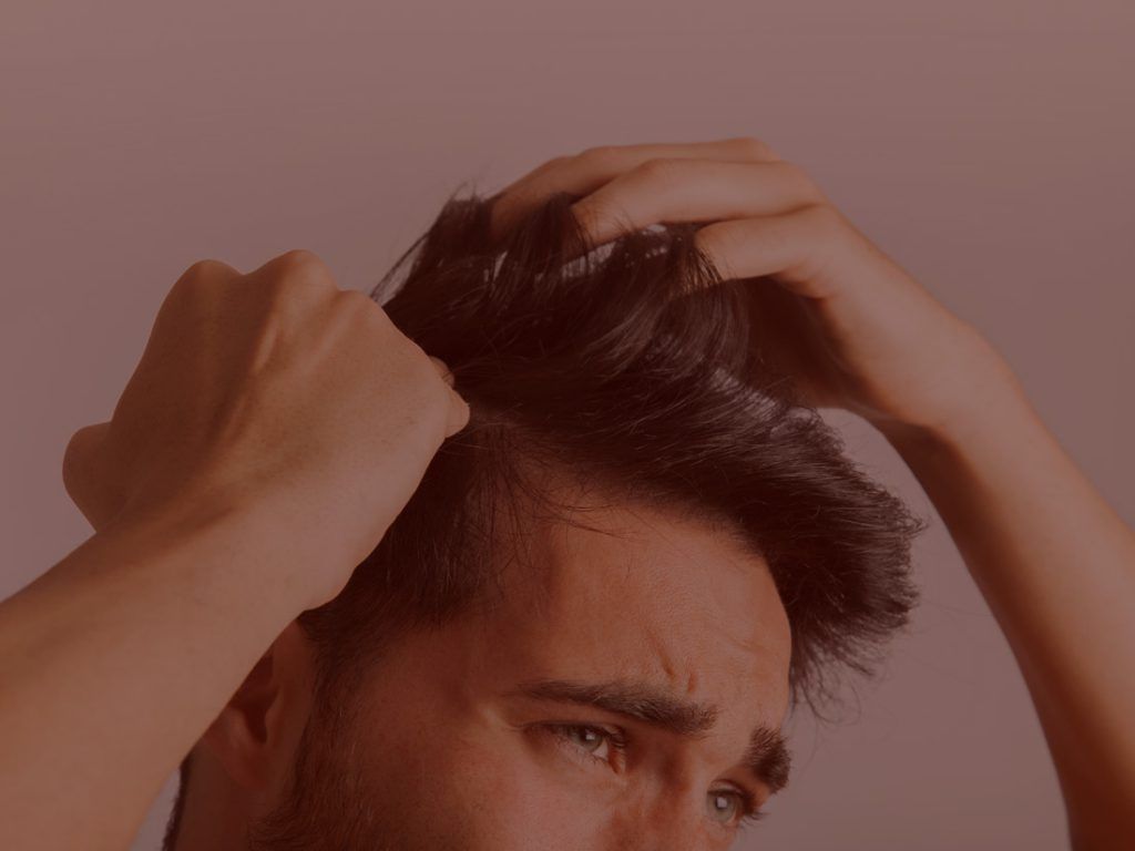 Tratamiento caida cabello hombres