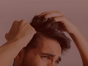 Tratamiento caida cabello hombres